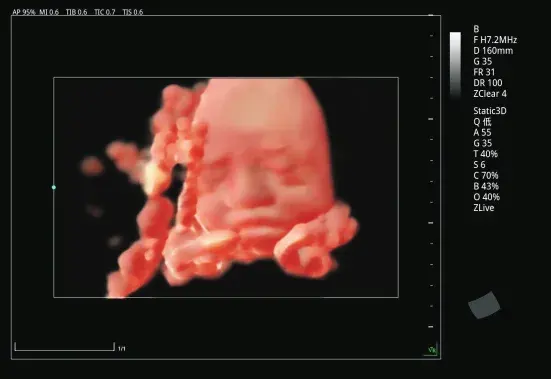3D / 4D obstetrik