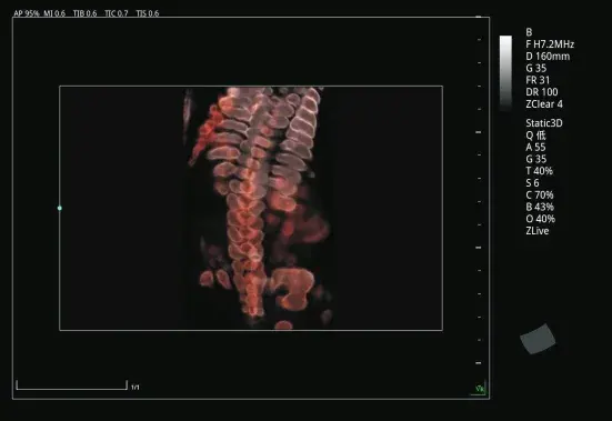 Silhouette Spine