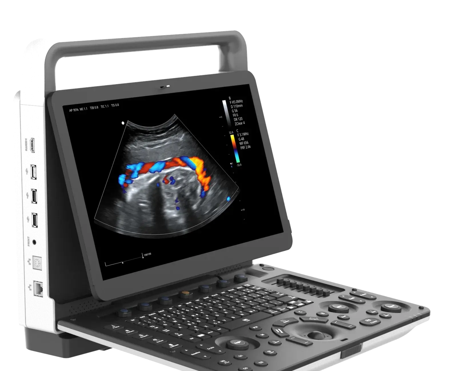 Zoncare M70 portatif renkli doppler ultrasonografi cihazı