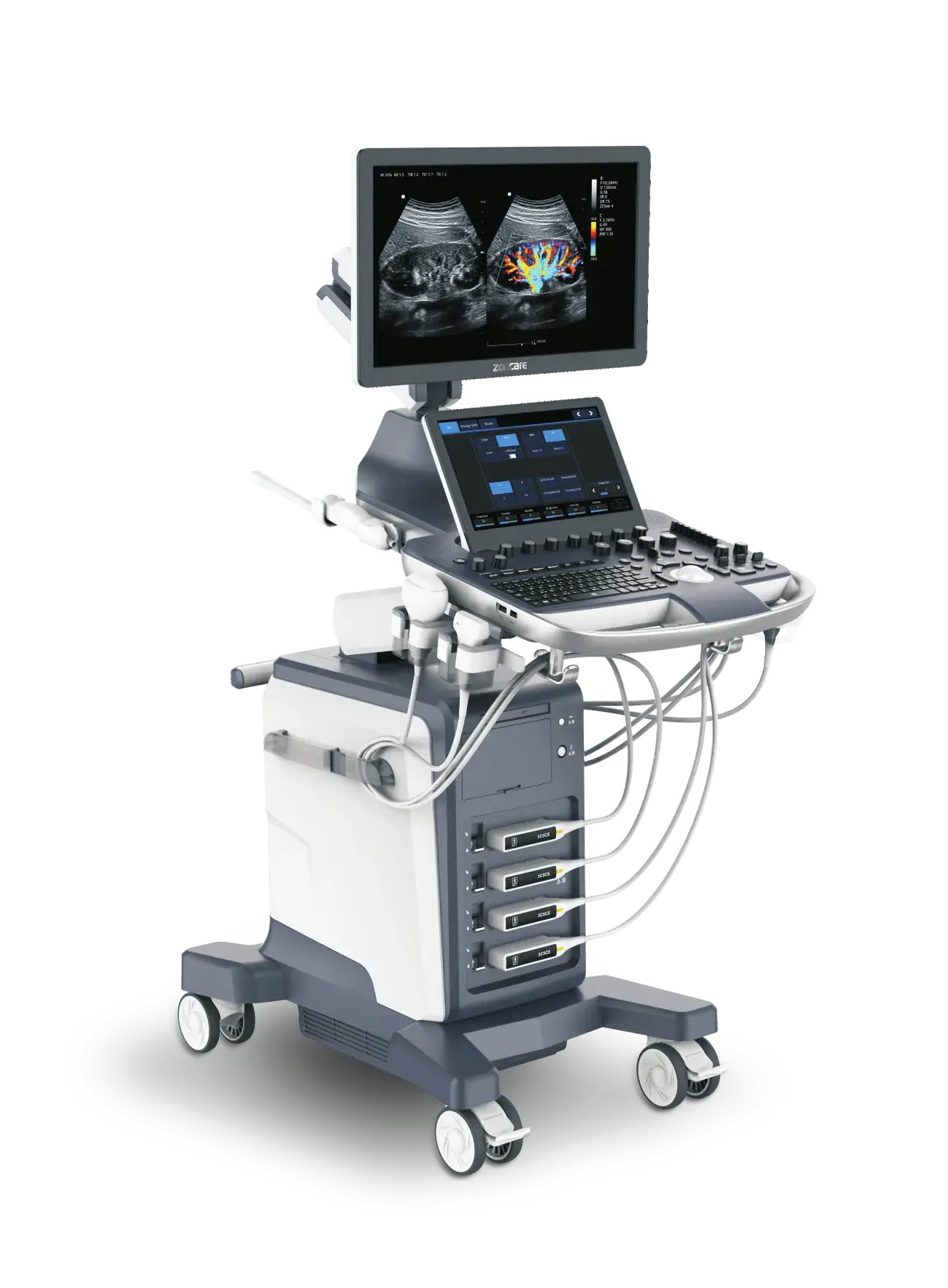 Zoncare ViV 60 renkli doppler ultrasonografi sistemi