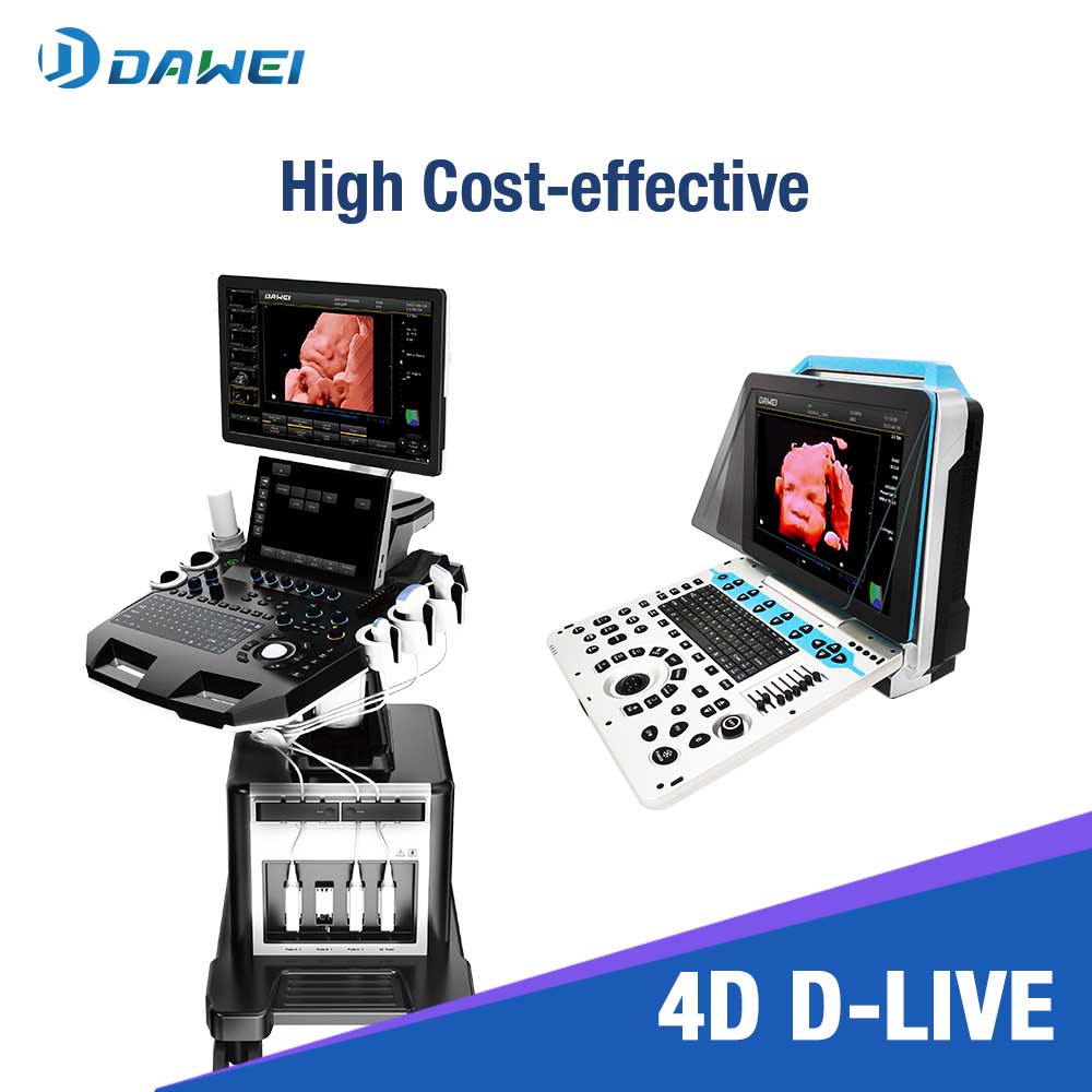 4D ultrasound machine