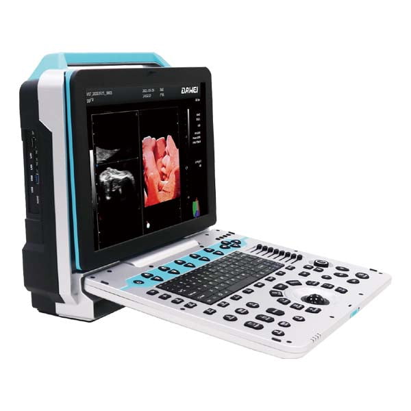 P50 ultrasound machine