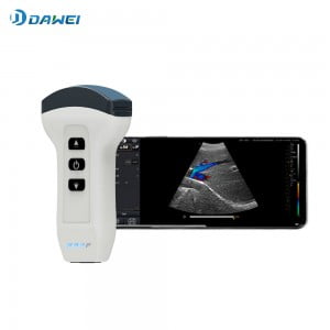 Wireless Handheld Ultrasound Scanner 300x300 1